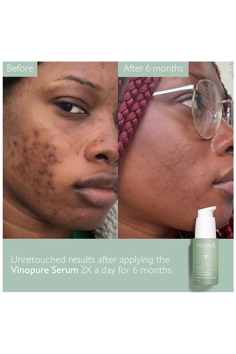 Vinopure Skin Perfecting Serum, Alternate, color, NO COLOR