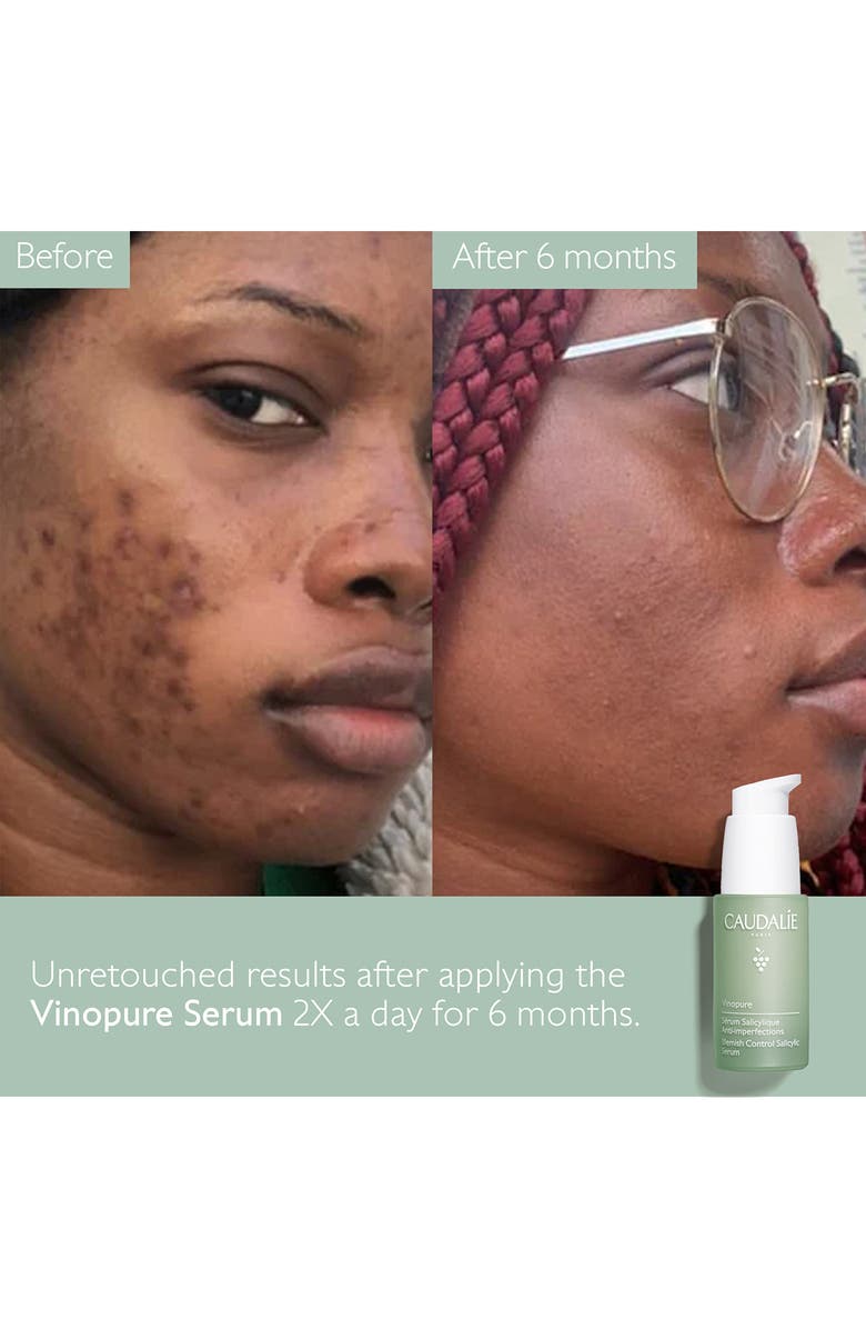 CAUDALÍE Vinopure Skin Perfecting Serum, Alternate, color,
