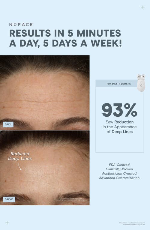 Nuface Trinity Complete Set With Augustinus Bader Skincare In No Color