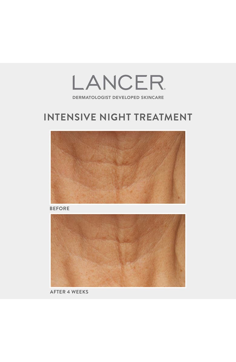 LANCER Skincare Intensive Night Treatment, Alternate, color,