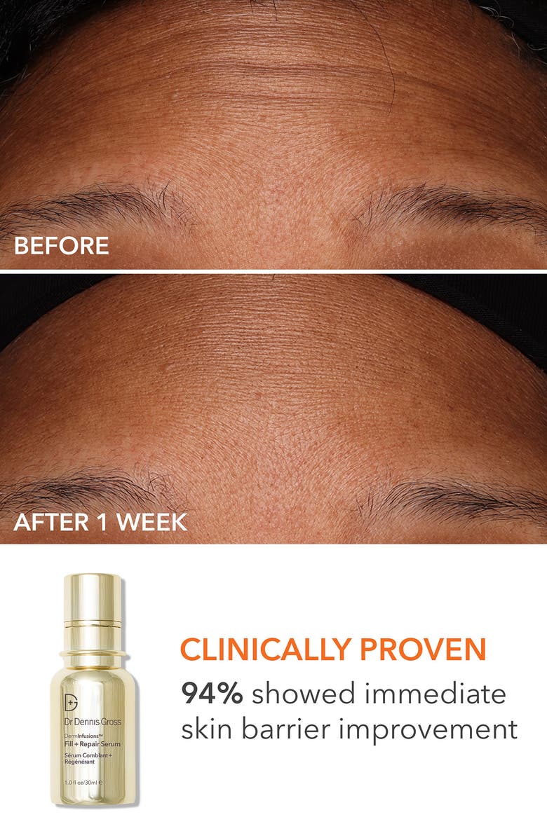 Dr. Dennis Gross Skincare DRx SpectraLite<sup>™</sup> FaceWare Pro LED Light Therapy Device & Skin Care Set $641 Value, Alternate, color,