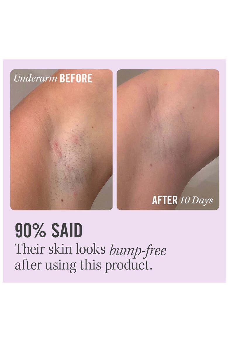 Ingrown Hair Pads with BHA & AHA, Alternate, color, NO COLOR