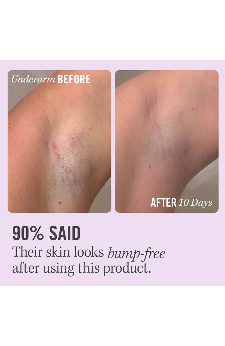 First Aid Beauty Ingrown Hair Pads with BHA & AHA, Alternate, color, 