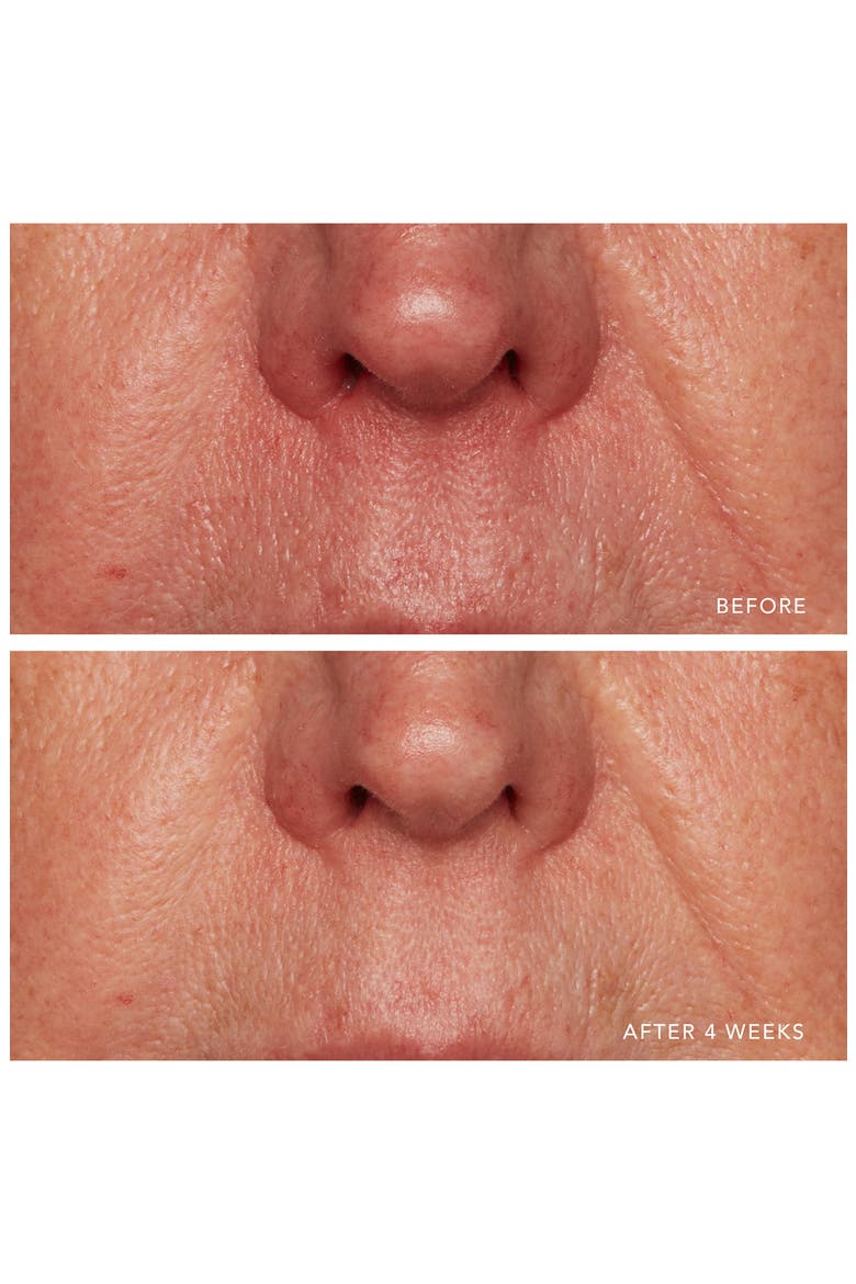 Redness Relief Intense with Manuka Honey, Alternate, color, NO COLOR
