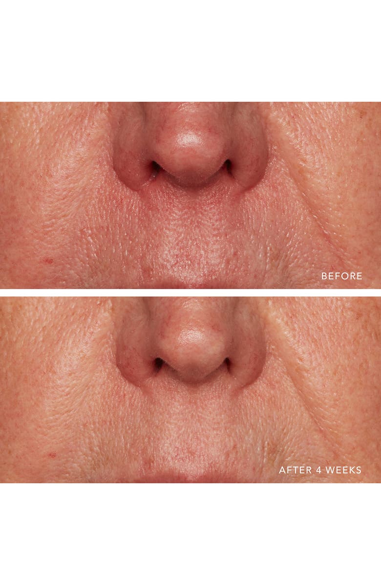 LANCER Skincare Redness Relief Intense with Manuka Honey, Alternate, color, 