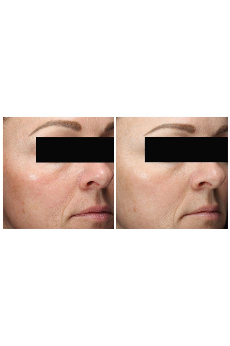 C&E Advanced with Hexylresorcinol and Silymarin Treatment Cream, Alternate, color, NO COLOR