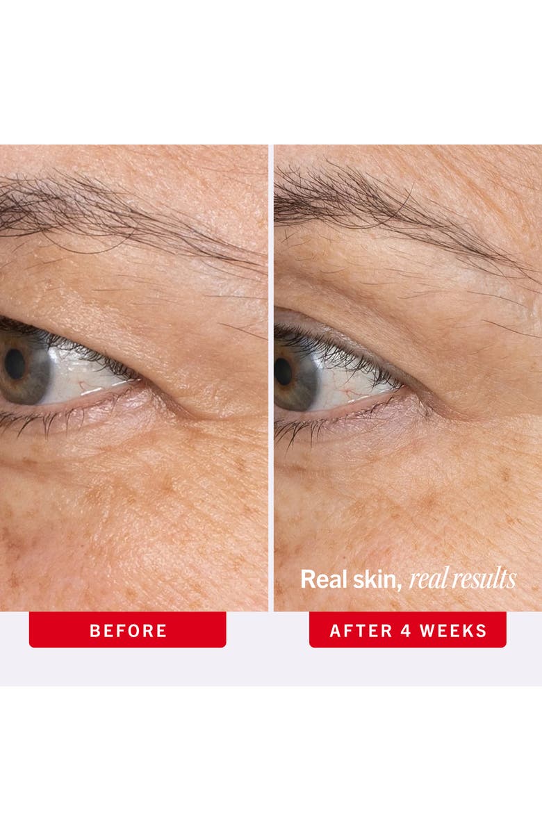 First Aid Beauty Ultra Repair Retinol Eye Cream with Retinol, Squalane & Ceramides, Alternate, color, 