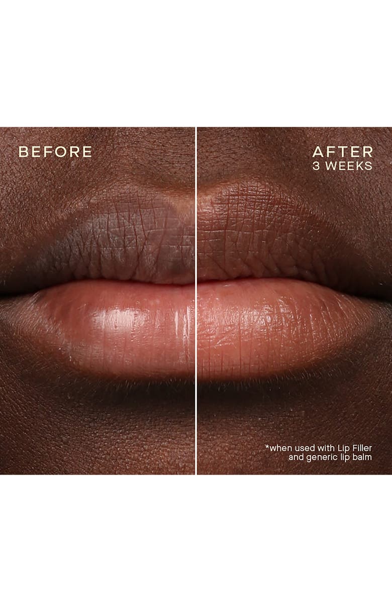 Ourself Lip Filler & Refill Cartridge Set, Alternate, color,