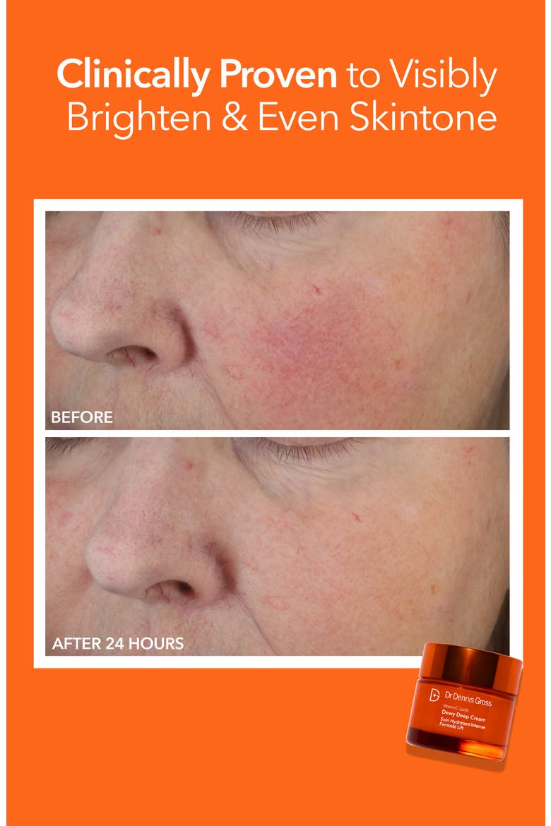 Vitamin C Lactic Dewy Deep Cream Duo $154 Value, Alternate, color, NO COLOR