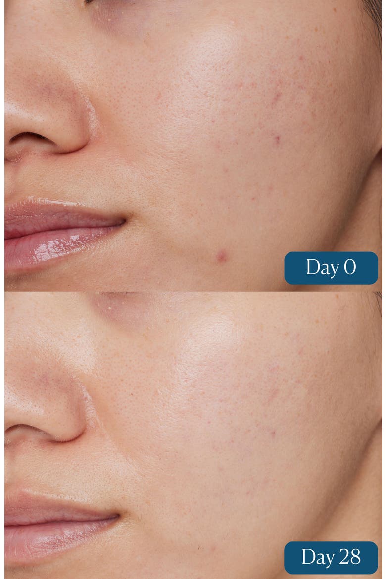 Dynamic Resurfacing Super-C Serum, Alternate, color, NO COLOR