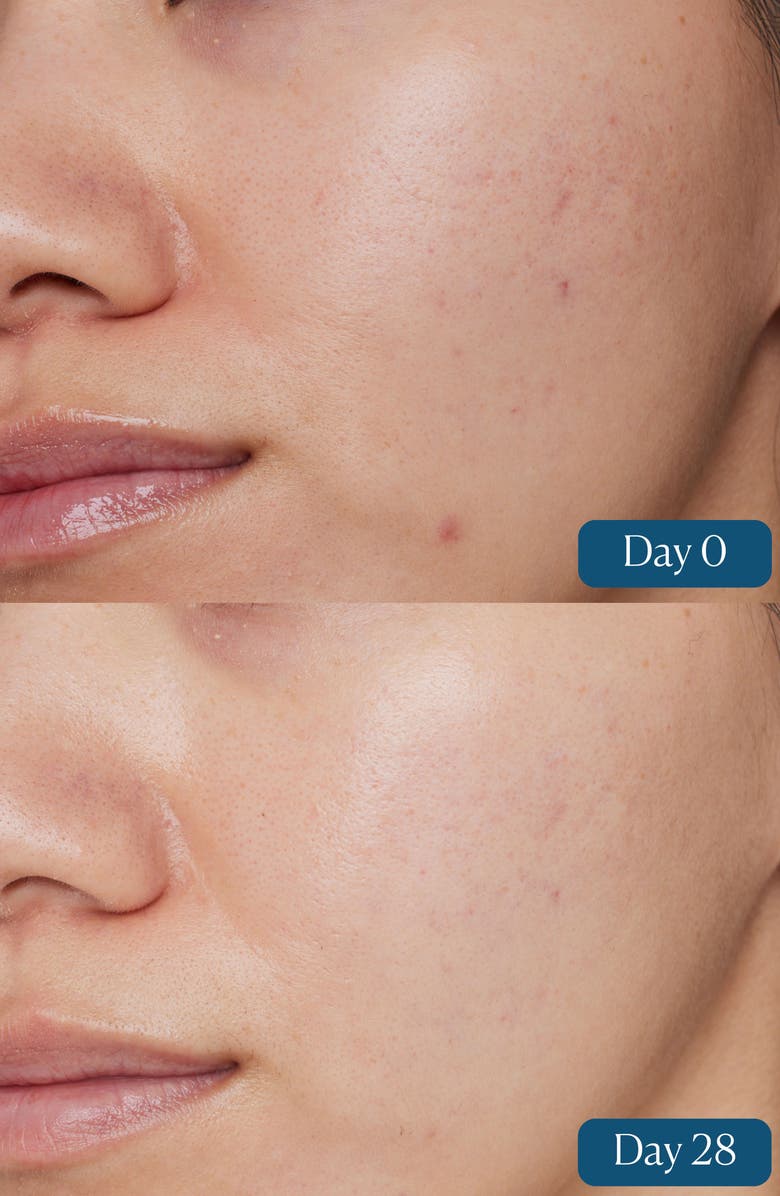 Elemis Dynamic Resurfacing Super-C Serum, Alternate, color,