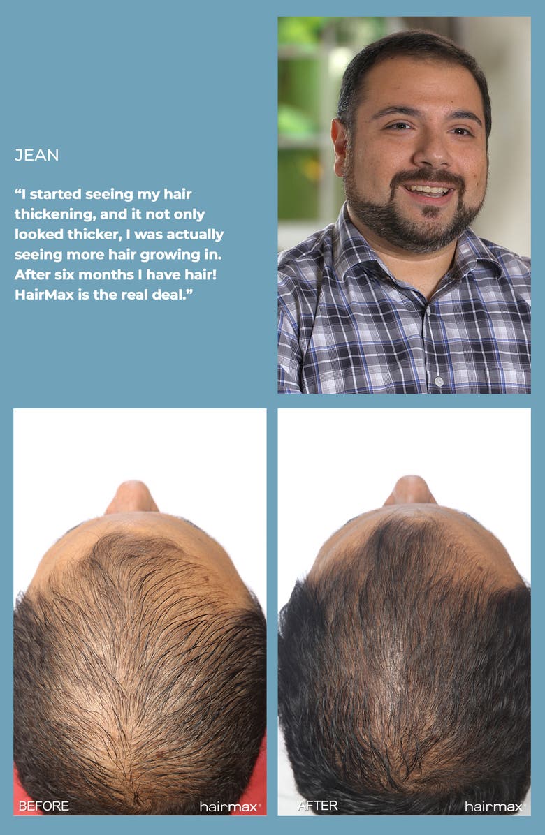 HAIRMAX<sup>®</sup> LaserBand 82 ComfortFlex Hair Growth Device, Alternate, color, Blue