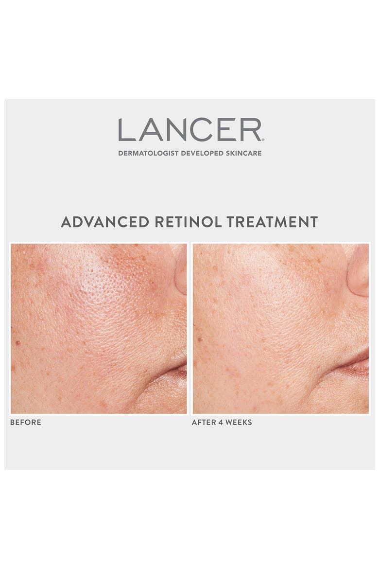 Advanced Retinol Treatment, Alternate, color, NO COLOR