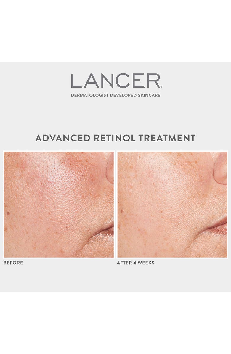 LANCER Skincare Advanced Retinol Treatment, Alternate, color,