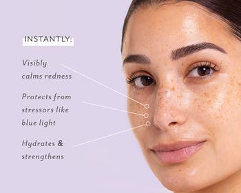 Skin Remedy Calm & Protect Mist