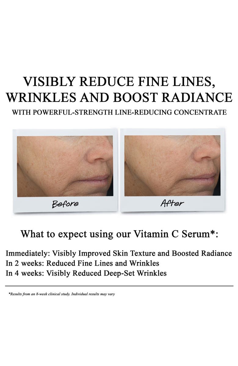 Kiehl's Since 1851 Powerful-Strength<sup>™</sup> Concentrate Set $196 Value, Alternate, color,