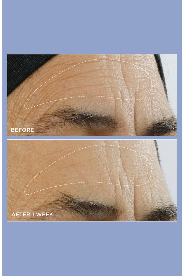 High Potency Triple Retinol Renewal Serum, Alternate, color, NO COLOR