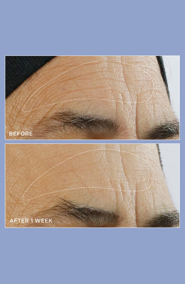 Perricone MD High Potency Triple Retinol Renewal Serum, Alternate, color,