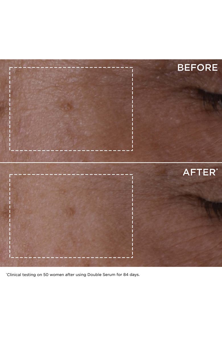 Clarins Double Serum & Extra-Firming - Smoothing Skin Care Set (Limited Edition) $210 Value, Alternate, color, 