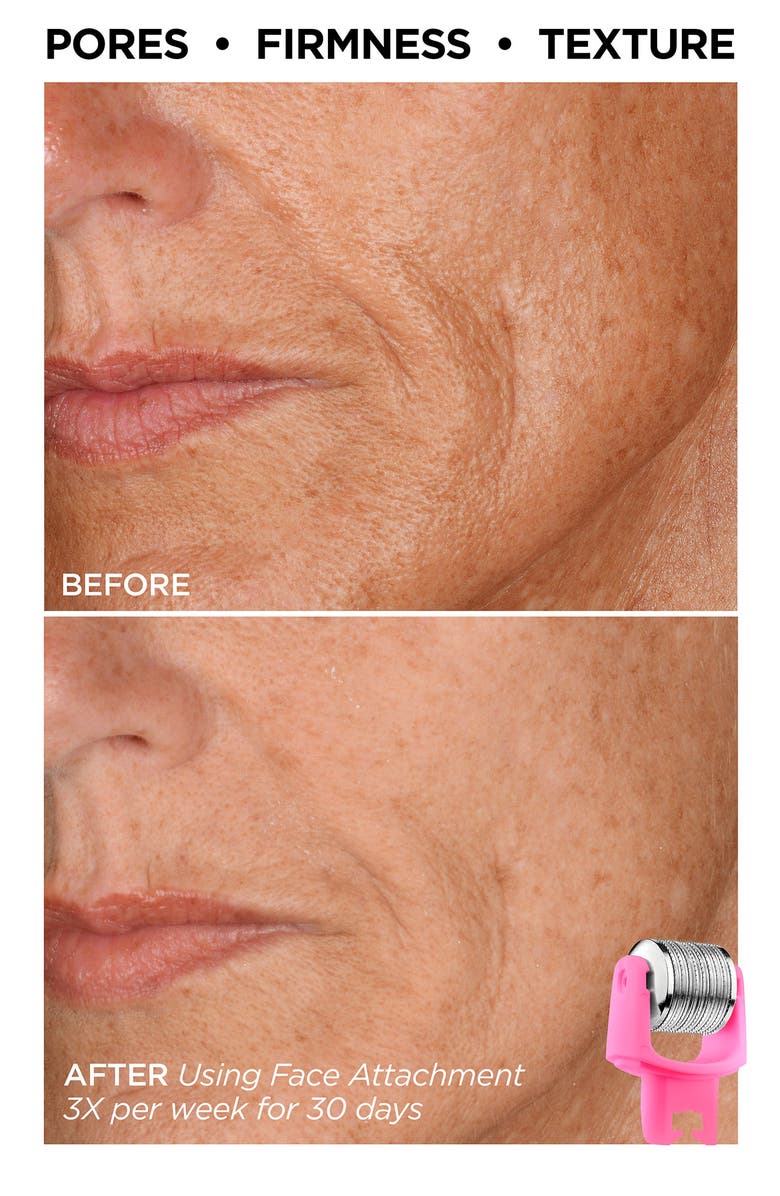 BeautyBio Showstopping Skin Set (Limited Edition) $326 Value, Alternate, color,