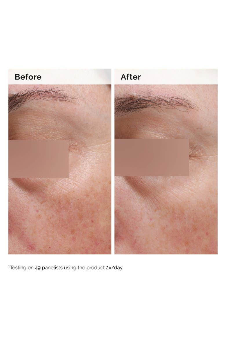 The Ordinary Salicylic Acid 0.5% Body Serum Exfoliating Treatment for Acne, Alternate, color, 