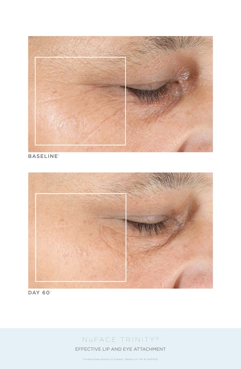 NuFACE<sup>®</sup> Trinity Advanced Lift Collection (Nordstrom Exclusive) USD $614 Value, Alternate, color,