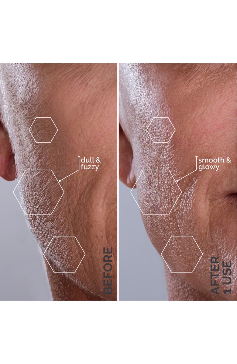 MICHAEL TODD BEAUTY Sonicsmooth At-home Sonic Dermaplaning System, Alternate, color, Reflects All Light Fully.