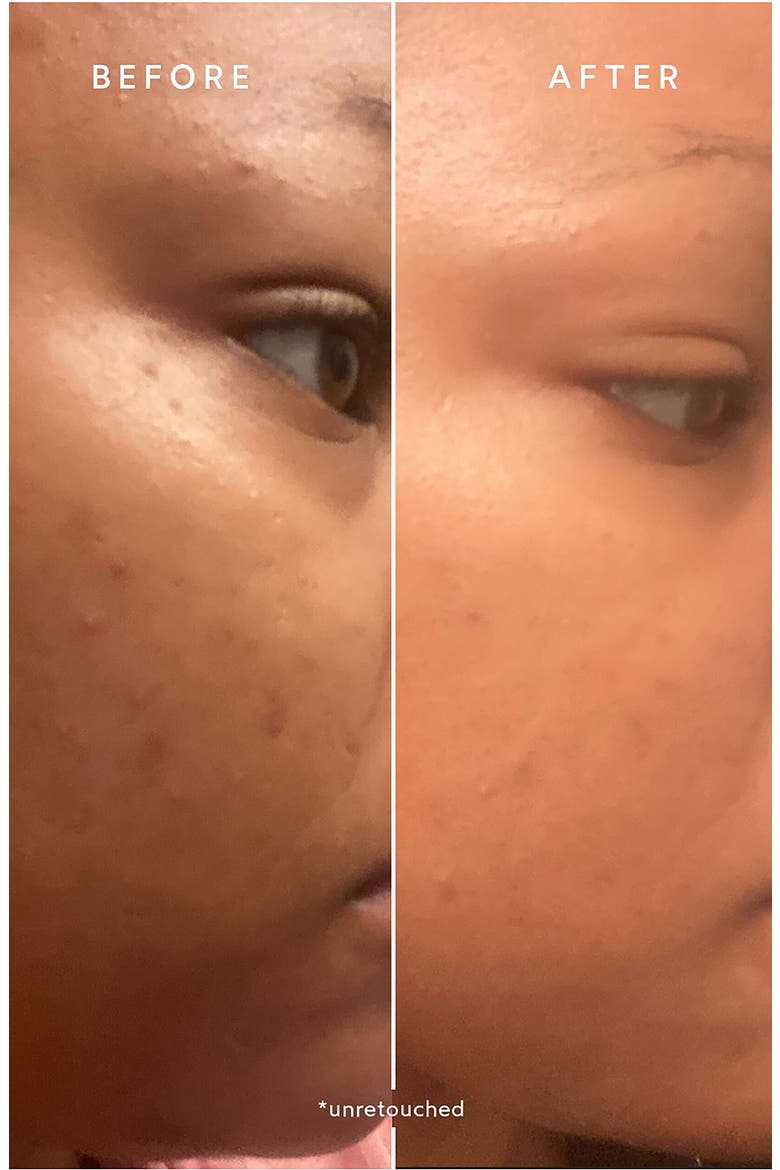 Niacinamide + Biotin Powder Booster, Alternate, color, NO COLOR