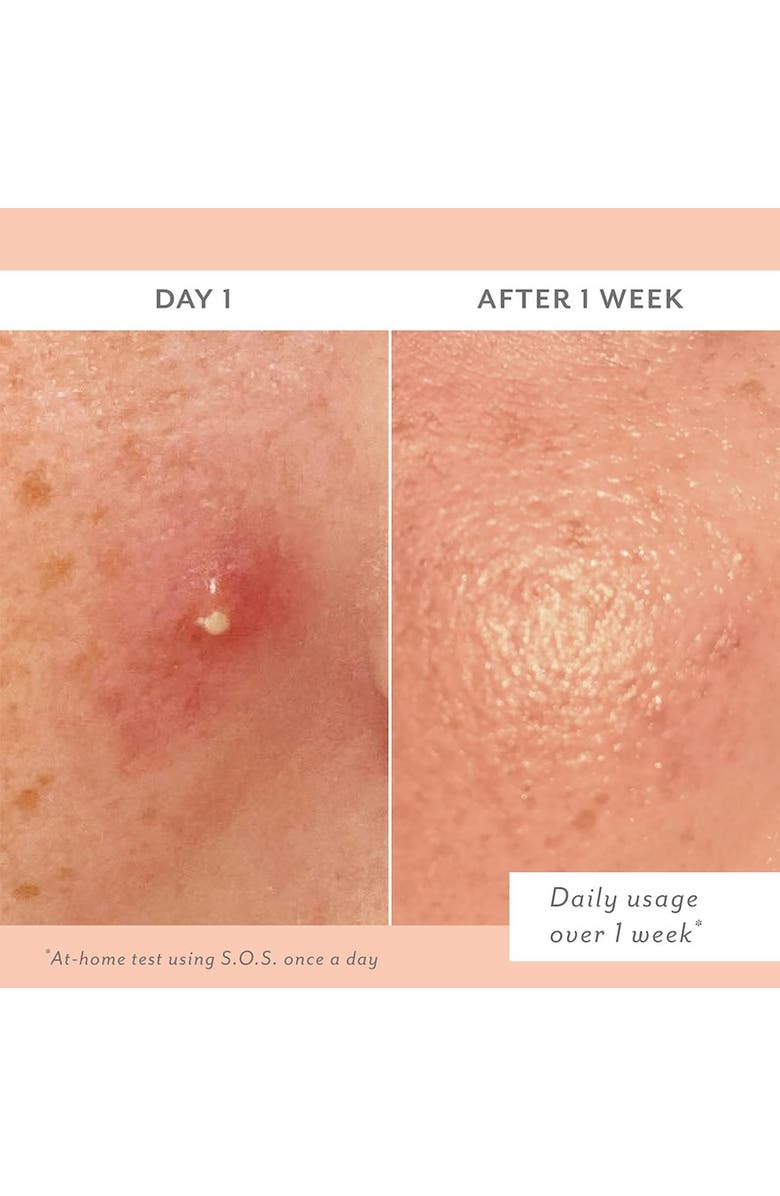 Patchology S.O.S. Clarifying Liquid Patch, Alternate, color, 