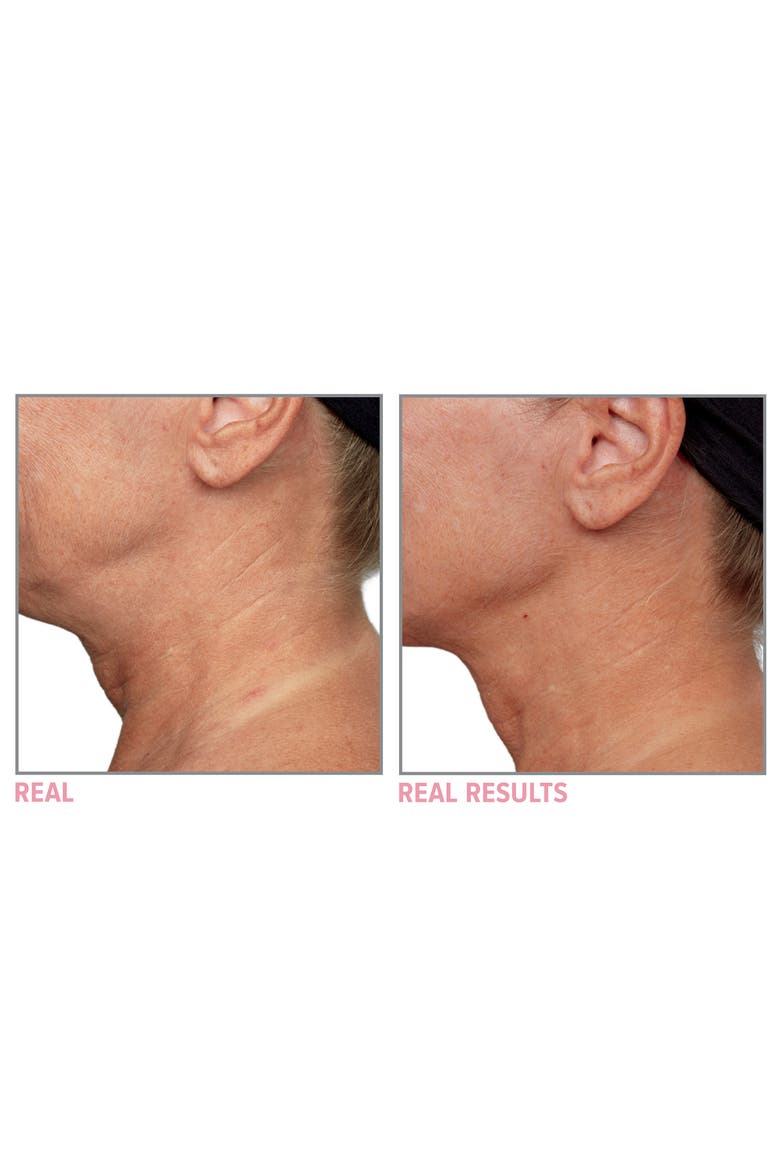 Confidence in a Neck Cream, Alternate, color, NO COLOR