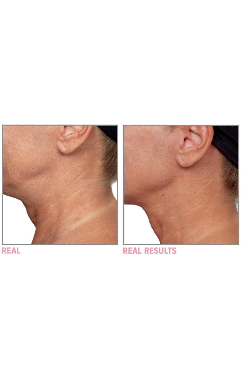 IT Cosmetics Confidence in a Neck Cream, Alternate, color,