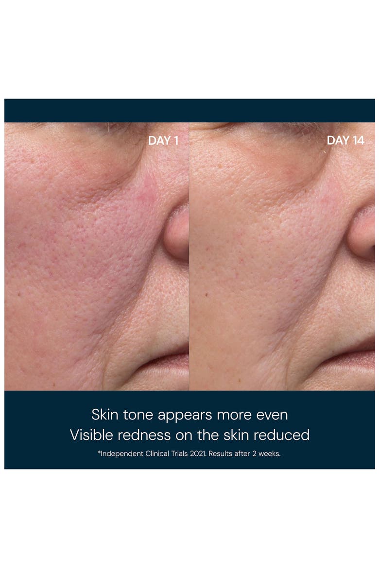 Dynamic Resurfacing Facial Pads, Alternate, color, NO COLOR