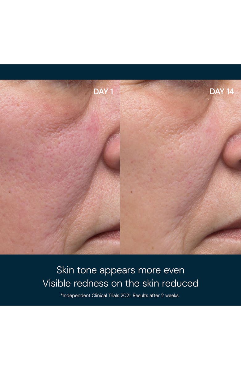 Elemis Dynamic Resurfacing Facial Pads, Alternate, color,