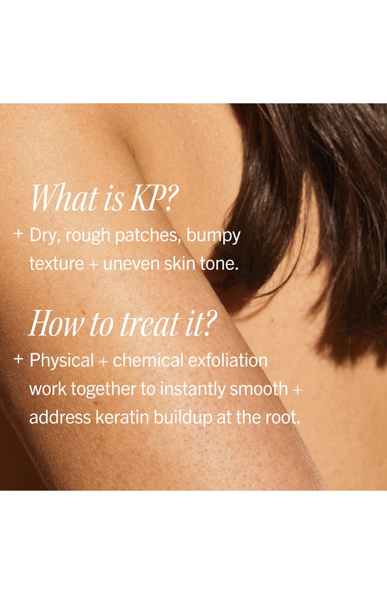 First Aid Beauty KP Bump Eraser Body Scrub with 10% AHA Toasted Coconut, Alternate, color, 