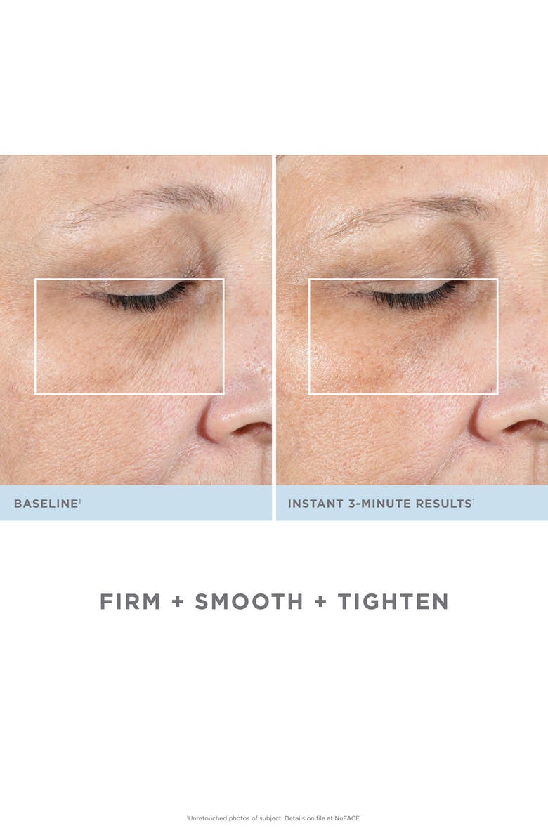 NuFACE<sup>®</sup> FIX Break The Ice Set, Alternate, color,