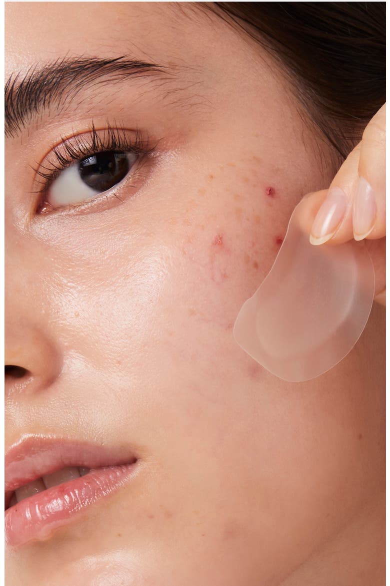 Timeout Blemish Patch Chin & Cheeks, Alternate, color, CLEAR