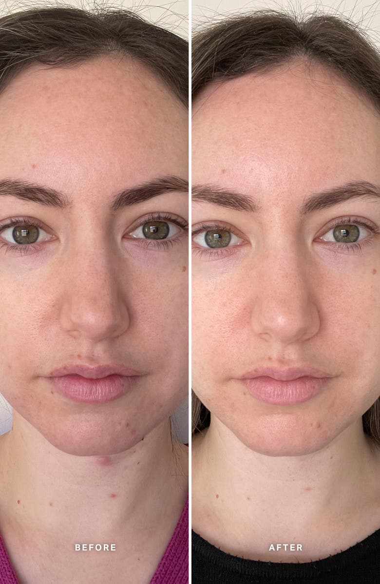 Alpha-H Vitamin B Serum with 5% Niacinamide, Alternate, color, 