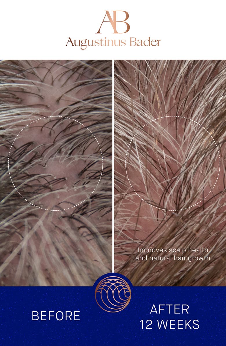 Augustinus Bader The Conditioner, Alternate, color,