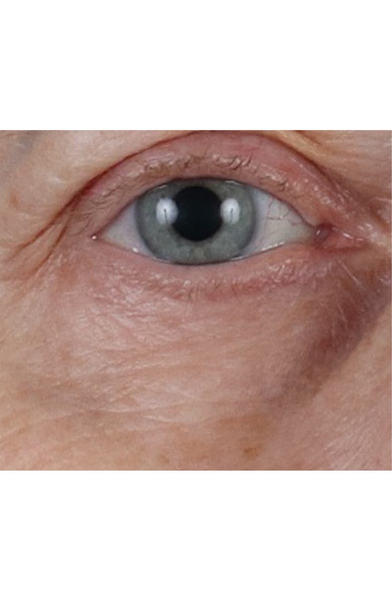 Perricone MD Vitamin C Ester CCC + Ferulic Brightening Under-Eye Cream, Alternate, color, 