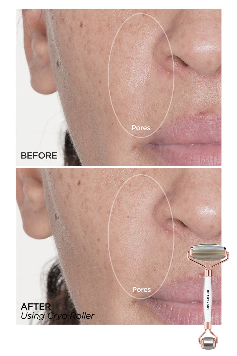 Cryo Dual Roller for Face, Eyes & Body Set $195 Value, Alternate, color, NO COLOR