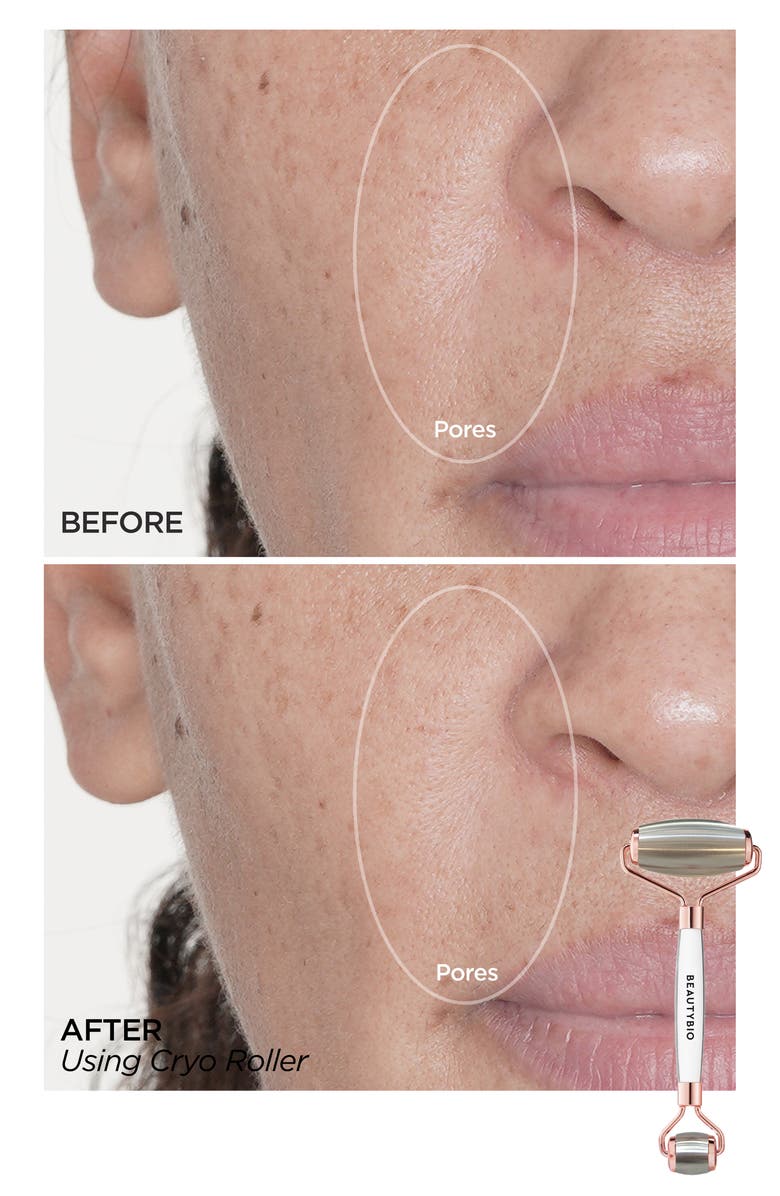 BeautyBio Cryo Dual Roller for Face, Eyes & Body Set $195 Value, Alternate, color, 