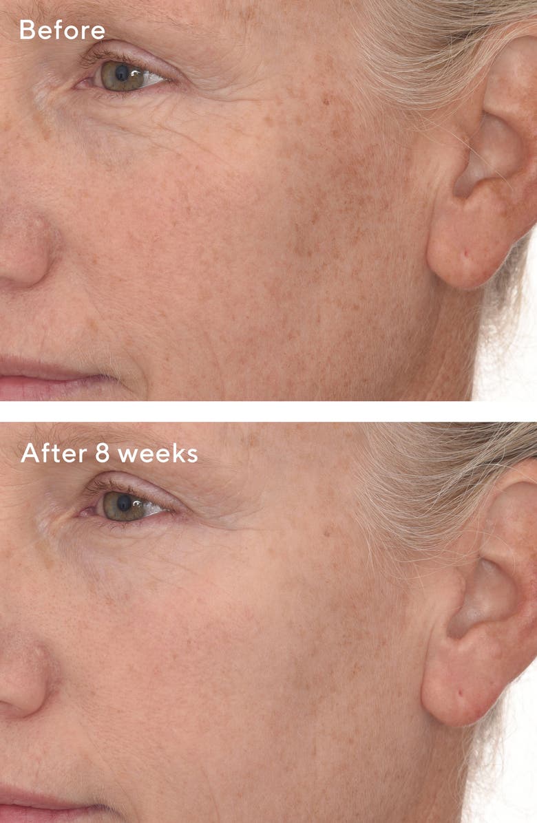 Murad<sup>®</sup> Resurgence<sup>™</sup> Retinal ReSculpt<sup>™</sup> Overnight Treatment, Alternate, color, 