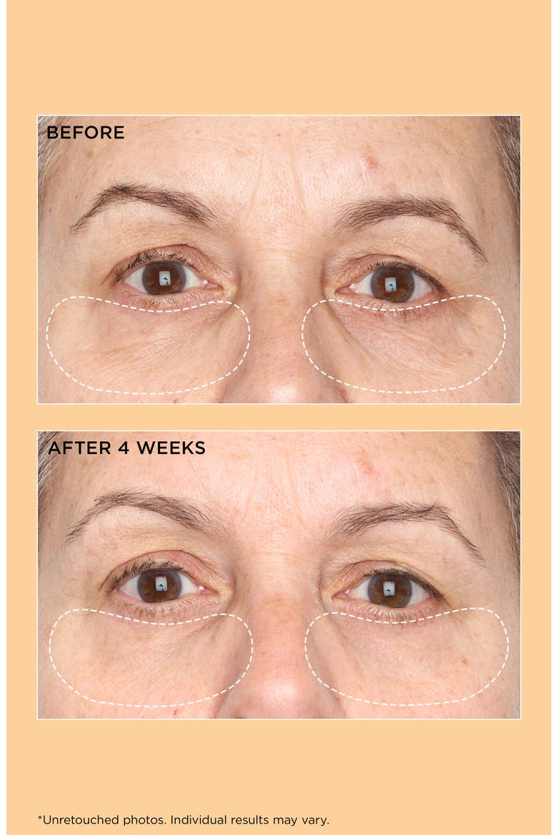 Neuropeptide Brightening Under-Eye Cream, Alternate, color, NO COLOR