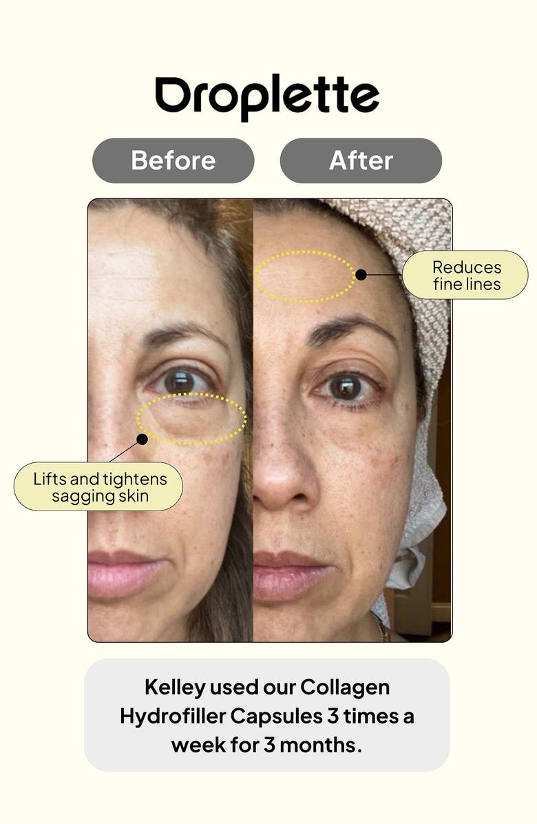 Droplette Collagen Hydrofiller Starter Set, Alternate, color, 