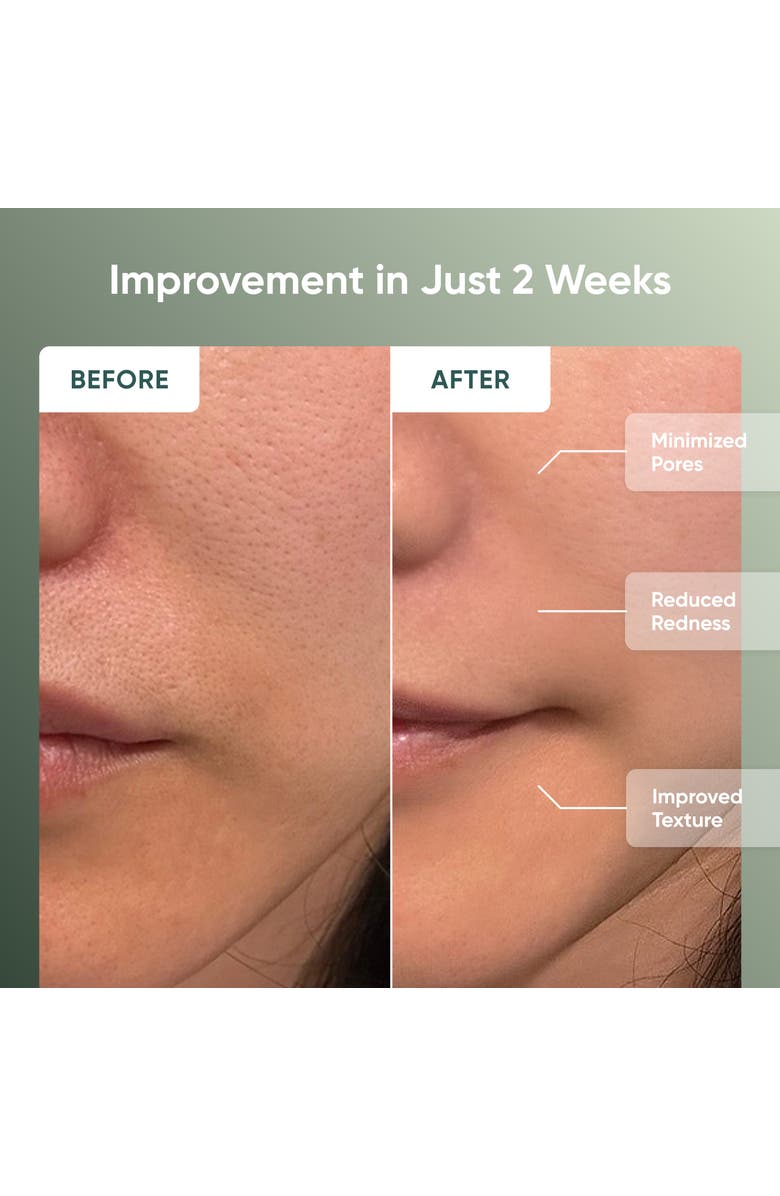 Nanoleaf LED Light Therapy Face Mask, Alternate, color, Multicolor