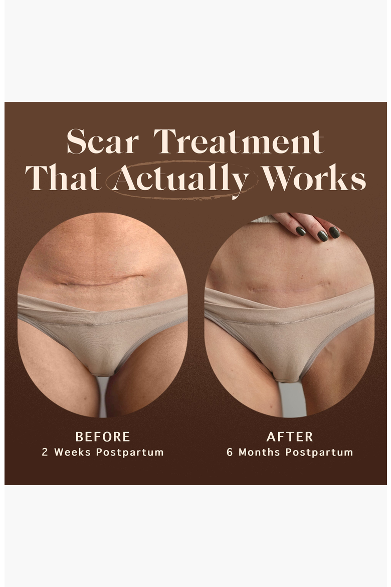 Renewing Scar Cream, Alternate, color, None