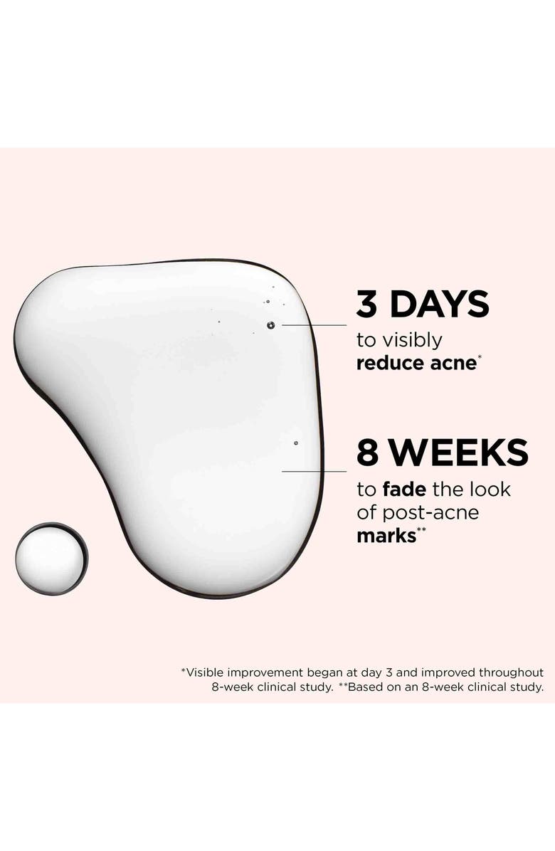 IT Cosmetics Bye Bye Breakout Salicylic Acid Acne Serum, Alternate, color,