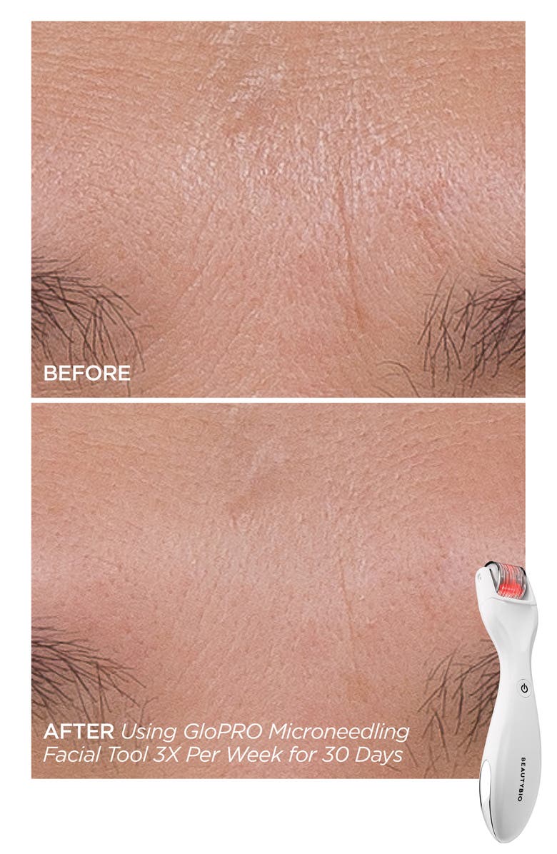 BeautyBio GloPRO Skin Care Set-$354 Value, Alternate, color,