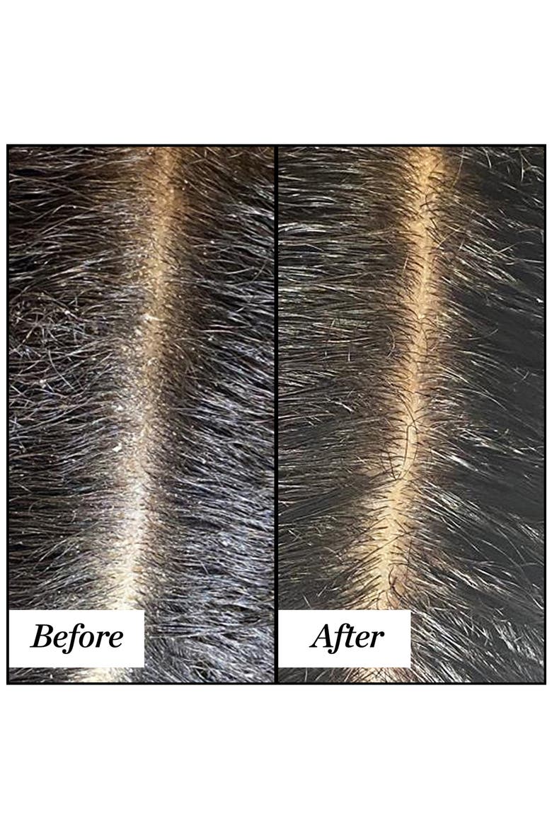 Clean Rinse Clarifying Scalp Serum, Alternate, color, NO COLOR
