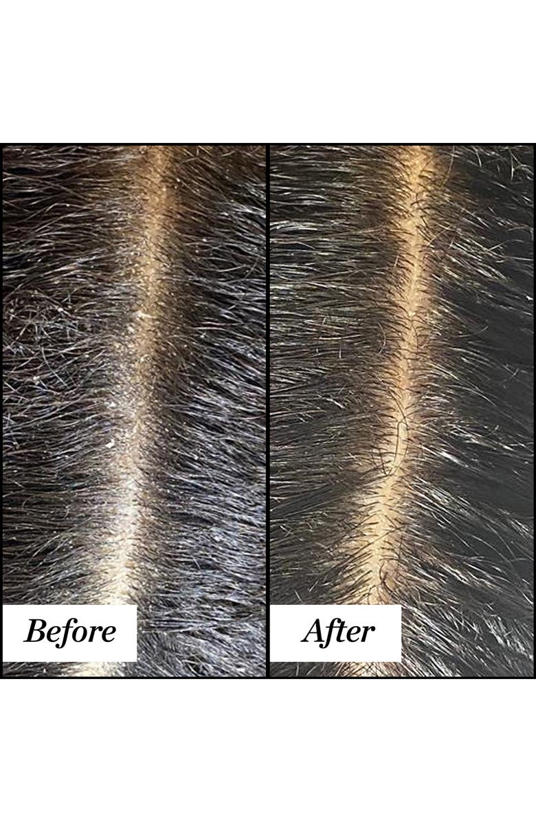 Sunday Riley Clean Rinse Clarifying Scalp Serum, Alternate, color,